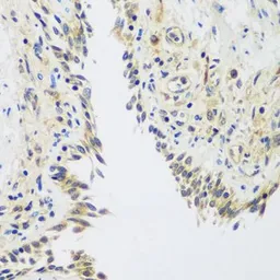 Anti-Rent2 antibody used in IHC (Paraffin sections) (IHC-P). GTX65954