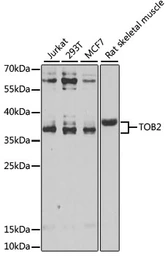 Anti-TOB2 antibody used in Western Blot (WB). GTX65957