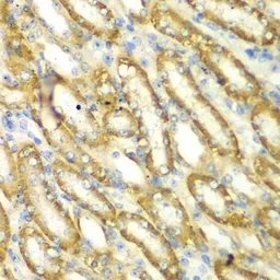 Anti-TM9SF1 antibody used in IHC (Paraffin sections) (IHC-P). GTX65959