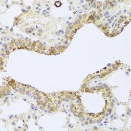 Anti-PDK3 antibody used in IHC (Paraffin sections) (IHC-P). GTX65965
