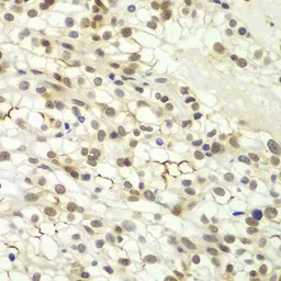 Anti-Lhx4 antibody used in IHC (Paraffin sections) (IHC-P). GTX65966