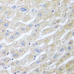 Anti-UCHL3 antibody used in IHC (Paraffin sections) (IHC-P). GTX65968