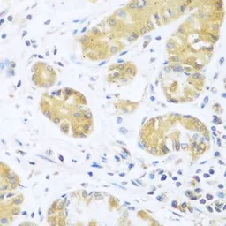 Anti-UCHL3 antibody used in IHC (Paraffin sections) (IHC-P). GTX65968