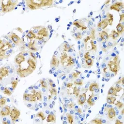 Anti-Ferrochelatase antibody used in IHC (Paraffin sections) (IHC-P). GTX65973