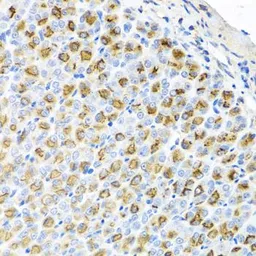 Anti-Ferrochelatase antibody used in IHC (Paraffin sections) (IHC-P). GTX65973