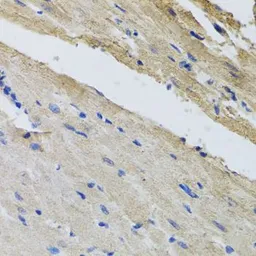 Anti-Ferrochelatase antibody used in IHC (Paraffin sections) (IHC-P). GTX65973