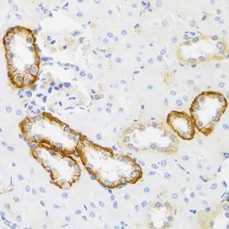 Anti-MYO5A antibody used in IHC (Paraffin sections) (IHC-P). GTX65990