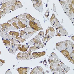 Anti-MRPS6 antibody used in IHC (Paraffin sections) (IHC-P). GTX65992