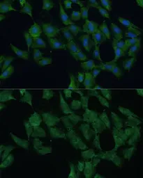 Anti-DDX3Y antibody used in Immunocytochemistry/ Immunofluorescence (ICC/IF). GTX66004