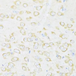 Anti-DDX3Y antibody used in IHC (Paraffin sections) (IHC-P). GTX66004