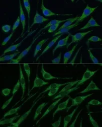 Anti-Valyl tRNA synthetase antibody used in Immunocytochemistry/ Immunofluorescence (ICC/IF). GTX66016