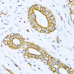 Anti-Valyl tRNA synthetase antibody used in IHC (Paraffin sections) (IHC-P). GTX66016