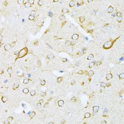 Anti-Valyl tRNA synthetase antibody used in IHC (Paraffin sections) (IHC-P). GTX66016