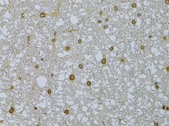 Anti-HDGFRP3 antibody used in IHC (Paraffin sections) (IHC-P). GTX66028