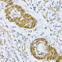 Anti-VAMP1 antibody used in IHC (Paraffin sections) (IHC-P). GTX66029