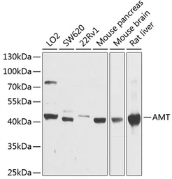 Anti-AMT antibody used in Western Blot (WB). GTX66030