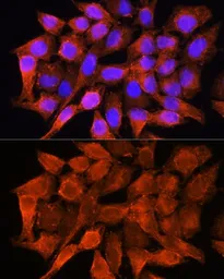 Anti-AMT antibody used in Immunocytochemistry/ Immunofluorescence (ICC/IF). GTX66030