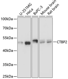 Anti-CtBP2 antibody used in Western Blot (WB). GTX66034