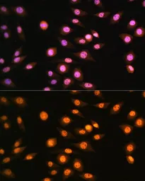 Anti-NR2F2 antibody used in Immunocytochemistry/ Immunofluorescence (ICC/IF). GTX66055