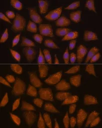 Anti-GCLC antibody used in Immunocytochemistry/ Immunofluorescence (ICC/IF). GTX66057