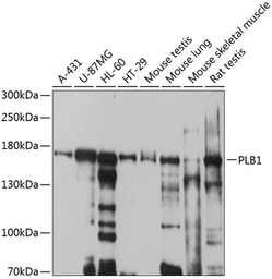 Anti-PLB1 antibody used in Western Blot (WB). GTX66060