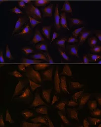 Anti-CRYZ antibody used in Immunocytochemistry/ Immunofluorescence (ICC/IF). GTX66130