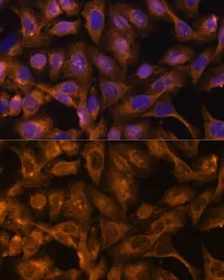 Anti-SEPT5 antibody used in Immunocytochemistry/ Immunofluorescence (ICC/IF). GTX66146