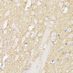 Anti-SEPT5 antibody used in IHC (Paraffin sections) (IHC-P). GTX66146
