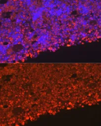 Anti-Neutrophil elastase antibody used in IHC (Paraffin sections) (IHC-P). GTX66150