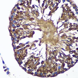 Anti-SENP1 antibody used in IHC (Paraffin sections) (IHC-P). GTX66159