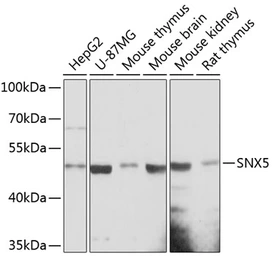 Anti-SNX5 antibody used in Western Blot (WB). GTX66173