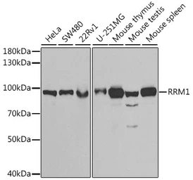 Anti-RRM1 antibody used in Western Blot (WB). GTX66190
