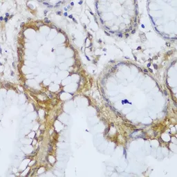 Anti-GCC2 antibody used in IHC (Paraffin sections) (IHC-P). GTX66210
