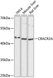 Anti-EFCAB4B antibody used in Western Blot (WB). GTX66215