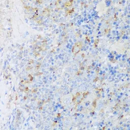 Anti-EFCAB4B antibody used in IHC (Paraffin sections) (IHC-P). GTX66215