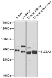 Anti-SLC6A2 antibody used in Western Blot (WB). GTX66236