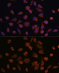 Anti-Mimitin antibody used in Immunocytochemistry/ Immunofluorescence (ICC/IF). GTX66245