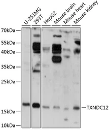 Anti-ERp19 antibody used in Western Blot (WB). GTX66255