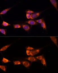 Anti-ERp19 antibody used in Immunocytochemistry/ Immunofluorescence (ICC/IF). GTX66255