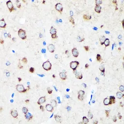 Anti-ERp19 antibody used in IHC (Paraffin sections) (IHC-P). GTX66255