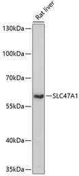 Anti-SLC47A1 antibody used in Western Blot (WB). GTX66266