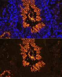 Anti-AKAP 82 antibody used in IHC (Paraffin sections) (IHC-P). GTX66294
