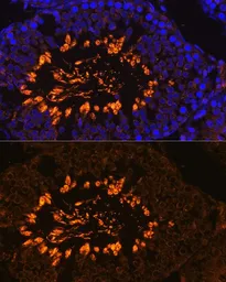 Anti-AKAP 82 antibody used in IHC (Paraffin sections) (IHC-P). GTX66294