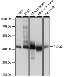 Anti-PDHA2 antibody used in Western Blot (WB). GTX66319