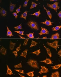 Anti-PDHA2 antibody used in Immunocytochemistry/ Immunofluorescence (ICC/IF). GTX66319