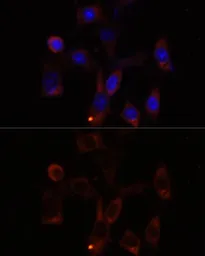 Anti-YTHDC2 antibody used in Immunocytochemistry/ Immunofluorescence (ICC/IF). GTX66320