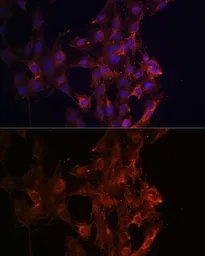 Anti-KIF5B antibody used in Immunocytochemistry/ Immunofluorescence (ICC/IF). GTX66352
