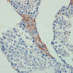 Anti-KIF5B antibody used in IHC (Paraffin sections) (IHC-P). GTX66352