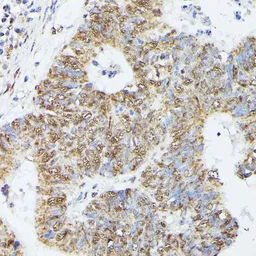 Anti-KIF22 antibody used in IHC (Paraffin sections) (IHC-P). GTX66353