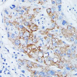 Anti-MANBA antibody used in IHC (Paraffin sections) (IHC-P). GTX66354